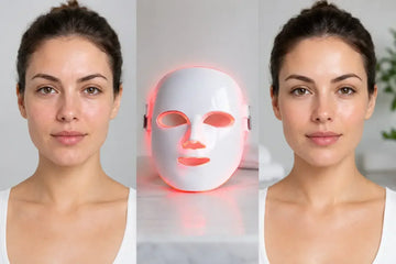 LED Mask Results Example: 12 Weeks of Change
